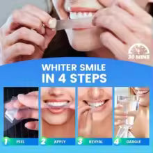 Velora 14-Day Smile Kit — Professional Whitening, Gentle on Enamel