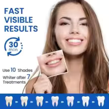 Velora 14-Day Smile Kit — Professional Whitening, Gentle on Enamel