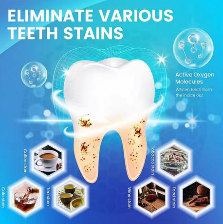 Velora Express Whitening Kit — See Results in One Week