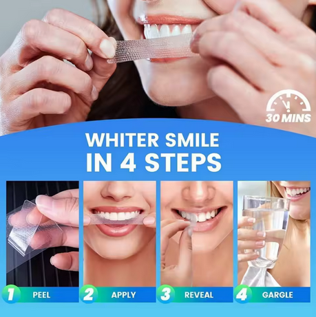 Velora Express Whitening Kit — See Results in One Week